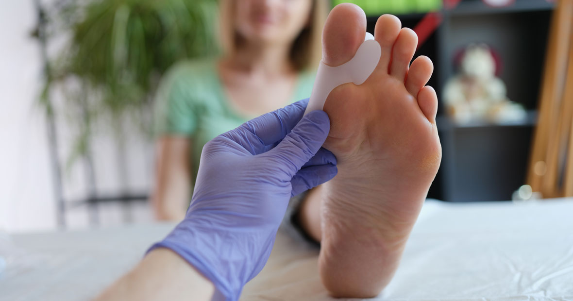 chirurgie de l'hallux valgus